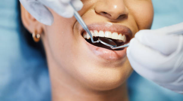 Best Emergency Tooth Extraction  in Hudson Oaks, TX