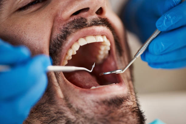 Best Knocked-Out Tooth Emergency  in Hudson Oaks, TX